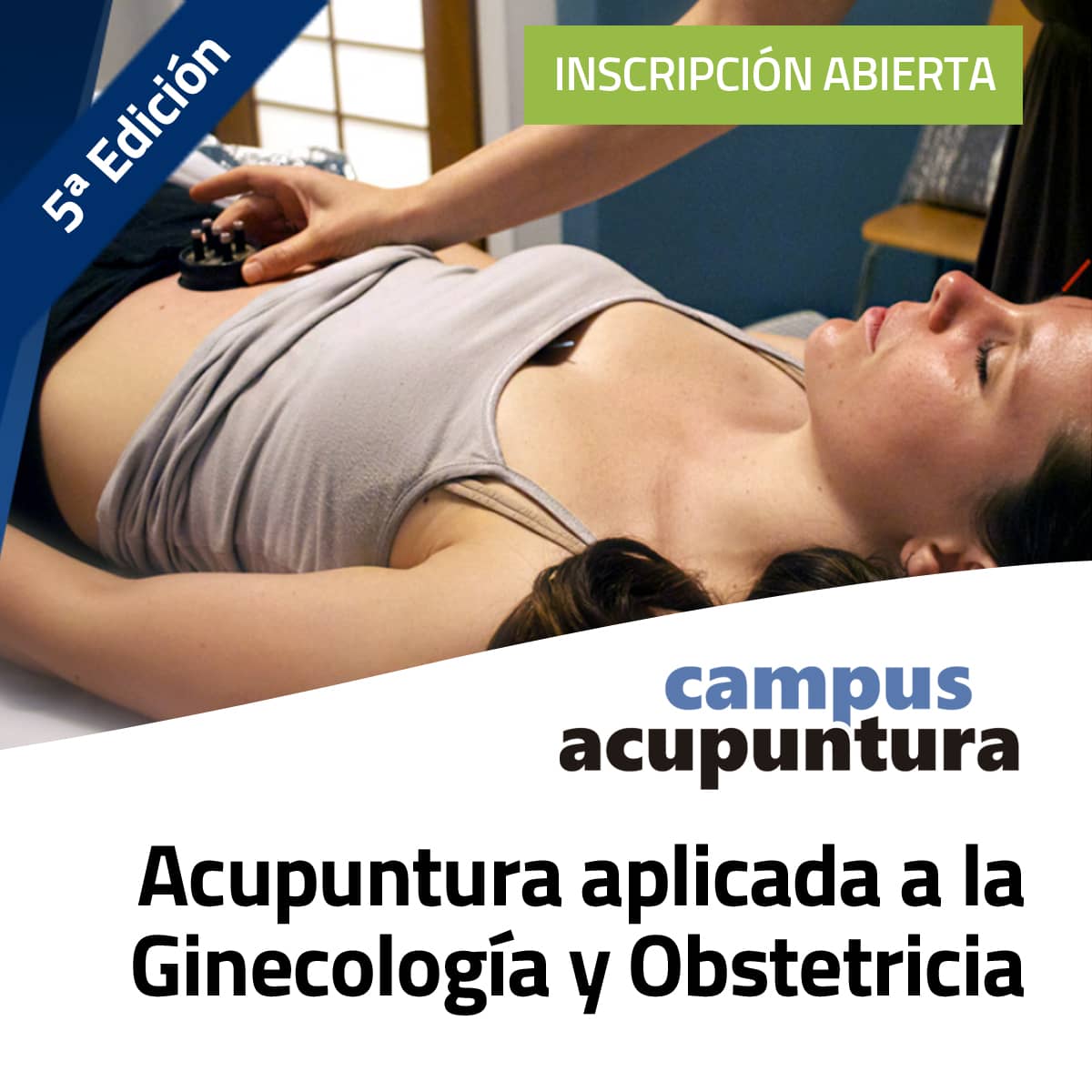 Acupuntura aplicada a la Ginecología y Obstetricia