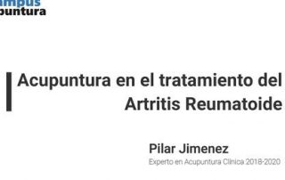 Acupuntura para el tratamiento de Artritis Reumatoide | Campus Acupuntura