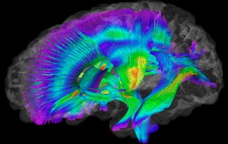 Efectividad de la acupuntura al re-mapear el cerebro