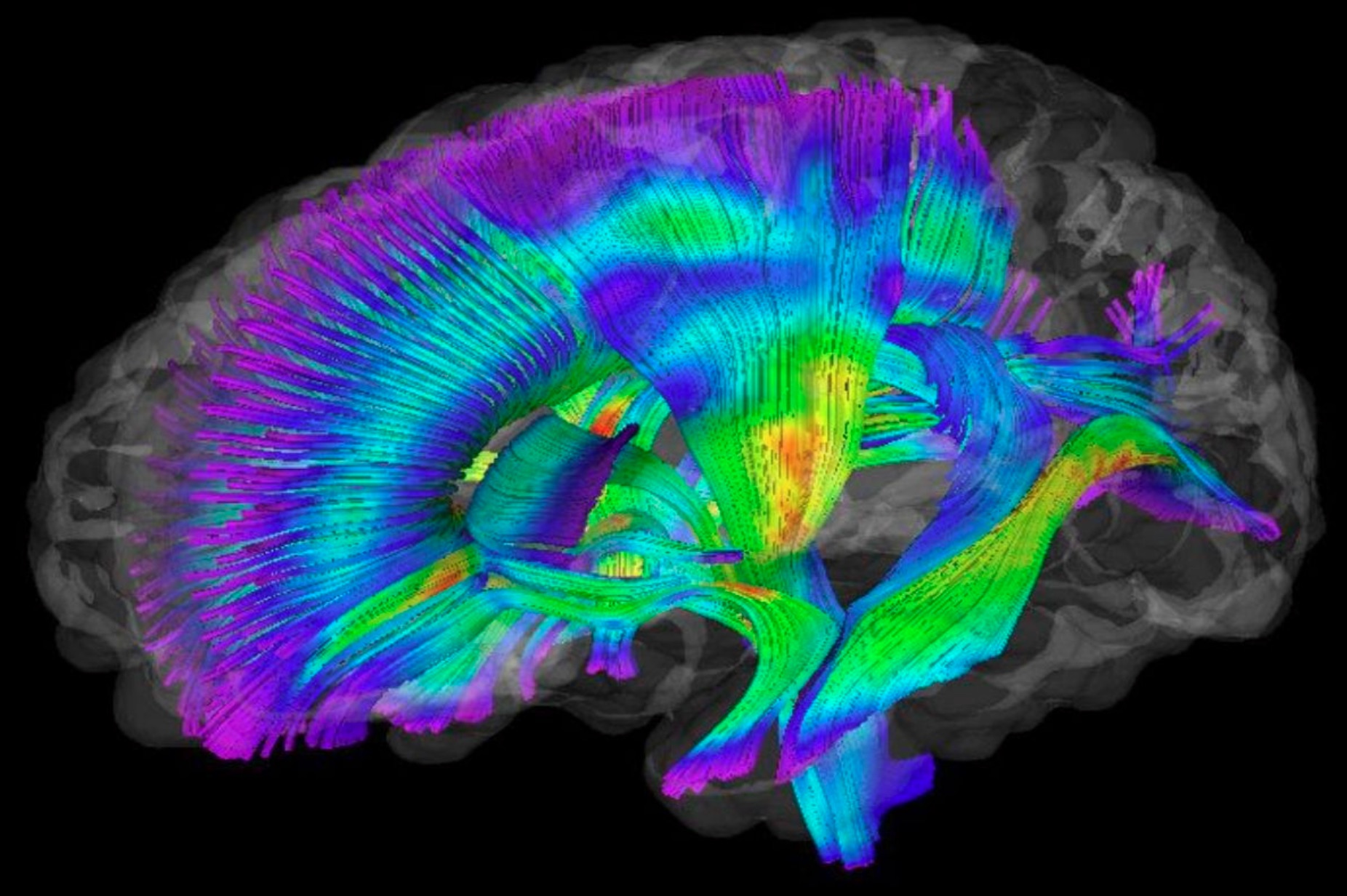 Efectividad de la acupuntura al re-mapear el cerebro Efectividad de la acupuntura al re-mapear el cerebro