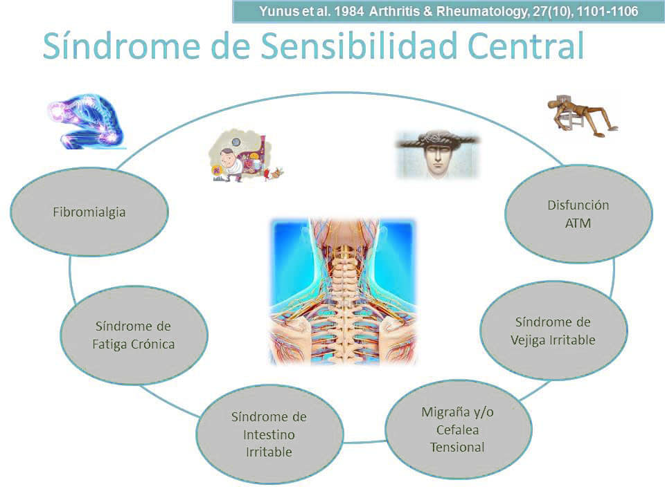 Compartimos un interesante post del Prof. Raúl Rubio sobre el tratamiento de la acupuntura en pacientes con fibromialgia Compartimos un interesante post del Prof. Raúl Rubio sobre el tratamiento de la acupuntura en pacientes con fibromialgia