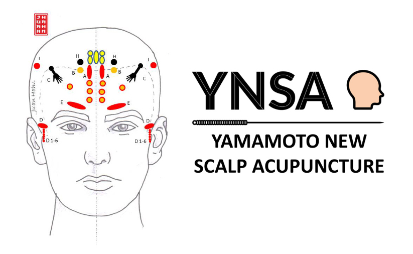 ymsa