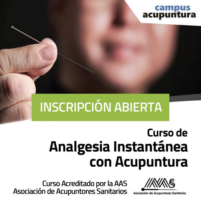 Curso Analgesia instantánea con Acupuntura