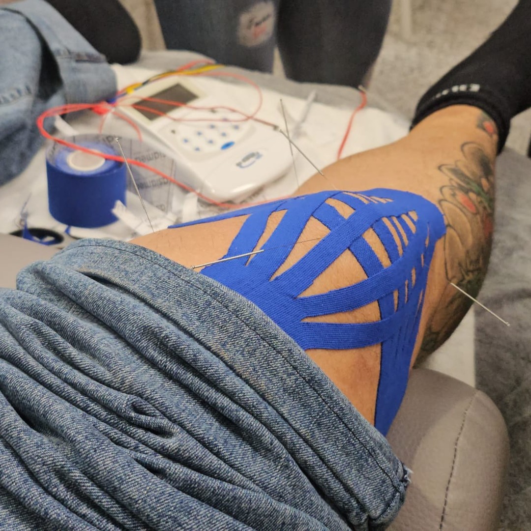 Los alumnos de segundo del Curso Experto en Acupuntura Clínica ya están entrando en la recta final 😮 Los alumnos de segundo del Curso Experto en Acupuntura Clínica ya están entrando en la recta final 😮