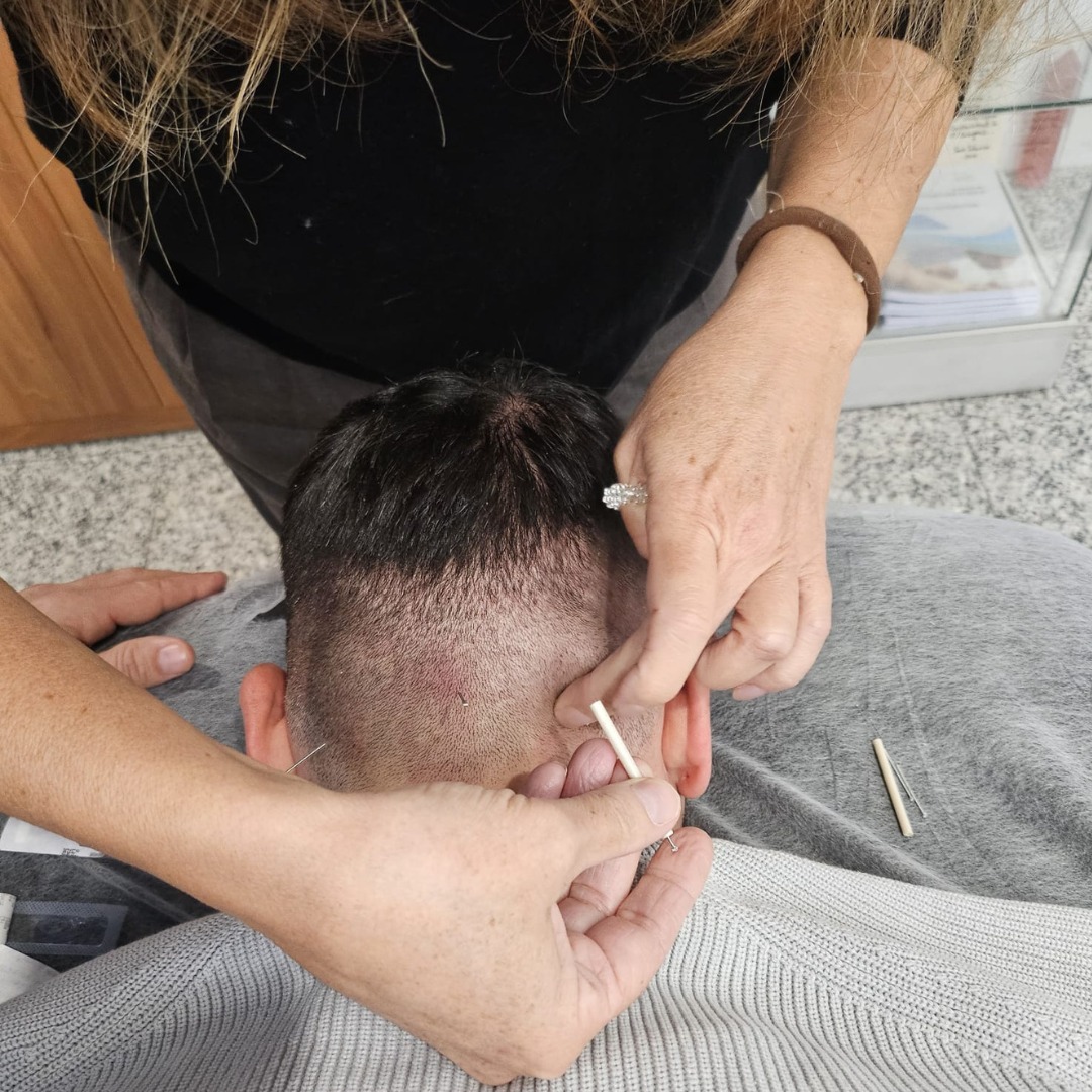 Los alumnos de segundo del Curso Experto en Acupuntura Clínica ya están entrando en la recta final 😮 Los alumnos de segundo del Curso Experto en Acupuntura Clínica ya están entrando en la recta final 😮